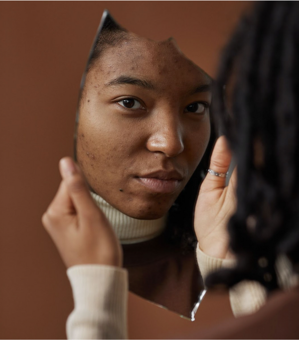 5 Common Sleep Habits That Are Ruining Your Skin